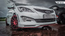Обвес "Zeus" Hyundai Solaris Restyling (2014+)